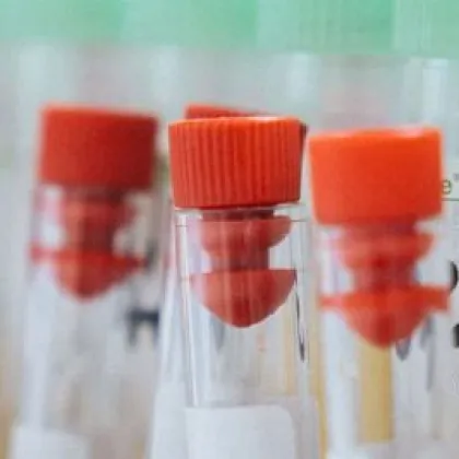 V ústavu hematologie chybí krev dárců skupin A a 0